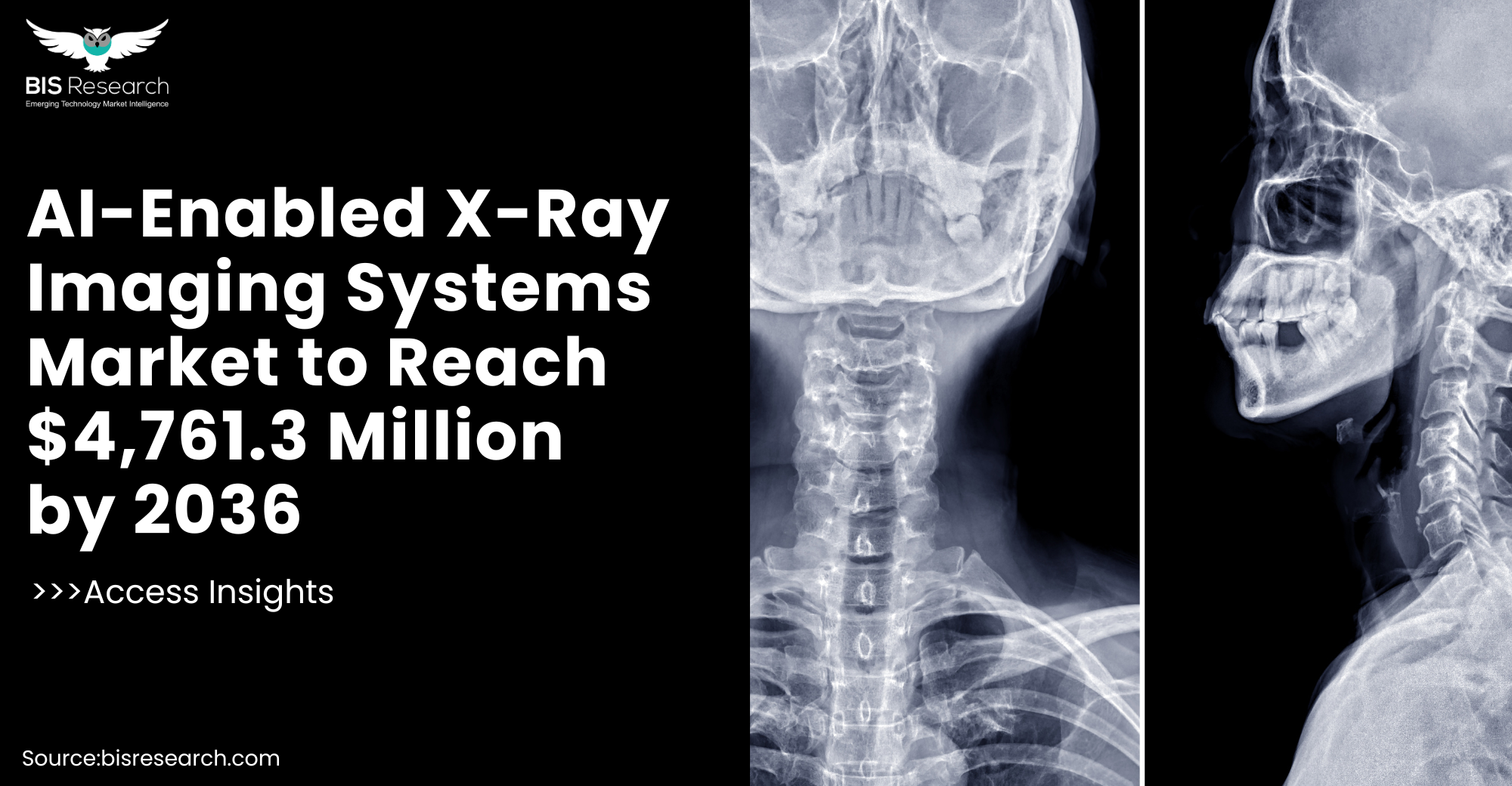 AI-Enabled X-Ray Imaging Systems Market to Reach $4,761.3 Million by 2036
