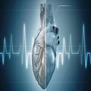 Cardiovascular Diseases Cardiovascular Diseases
