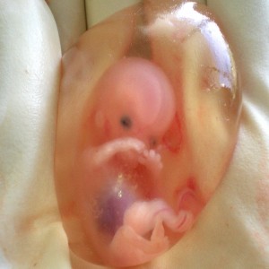 Global Prenatal Testing and Newborn Screening Market Global Prenatal Testing and Newborn Screening Market