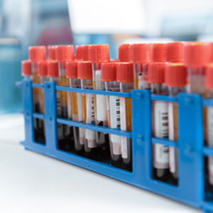 Hematologic Malignancies Testing Market Hematologic Malignancies Testing Market