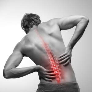 Axial Spondyloarthritis Axial Spondyloarthritis