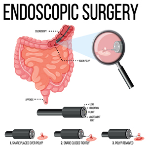 Laparoscopy and Endoscopy Devices Market News Laparoscopy and Endoscopy Devices Market News