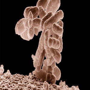 Microbiome Therapeutics Market Microbiome Therapeutics Market