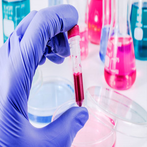 Europe Infectious Disease Diagnostics Market Europe Infectious Disease Diagnostics Market