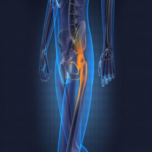 Global Orthopedics Devices Market Global Orthopedics Devices Market